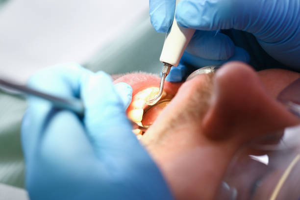 Best Emergency Dental Services for Seniors in Reading, MI