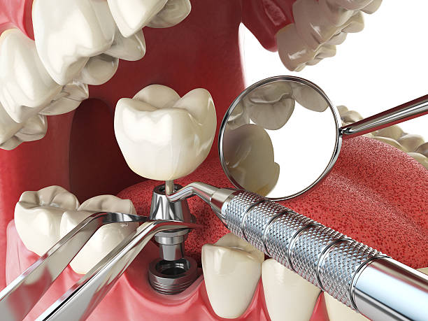 Best Emergency Dentist for Special Needs Patients in Reading, MI