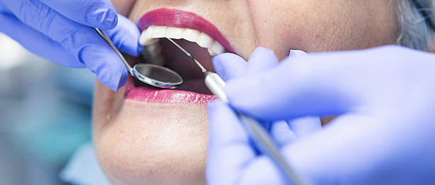 Best Emergency Dental Care for Abscessed Tooth in Reading, MI
